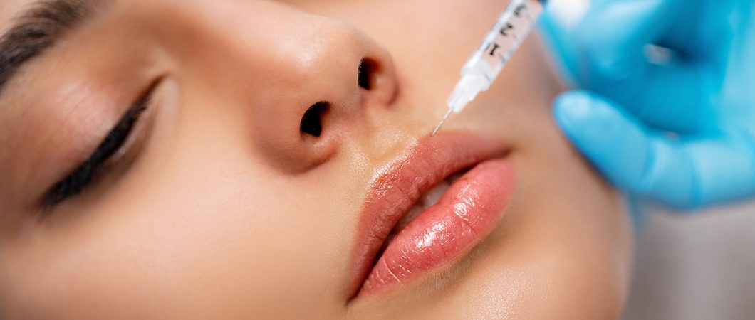 lippen opvullen amsterdam