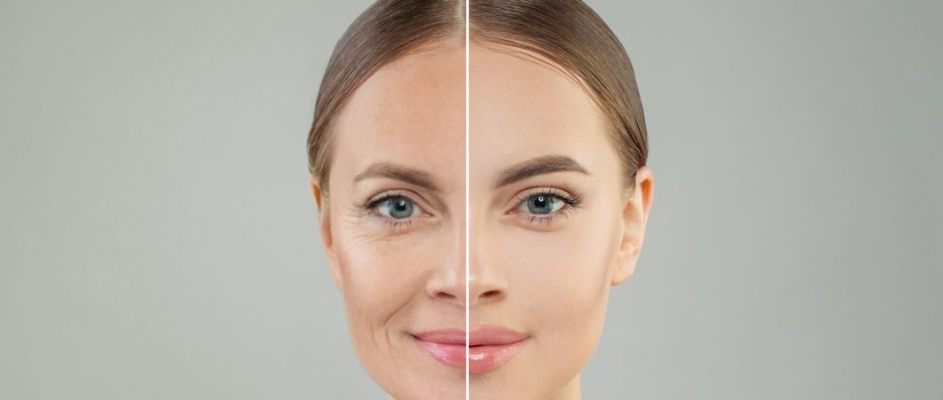 Wat helpt echt tegen rimpels